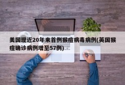 美国现近20年来首例猴痘病毒病例(英国猴痘确诊病例增至57例)