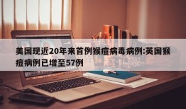 美国现近20年来首例猴痘病毒病例:英国猴痘病例已增至57例